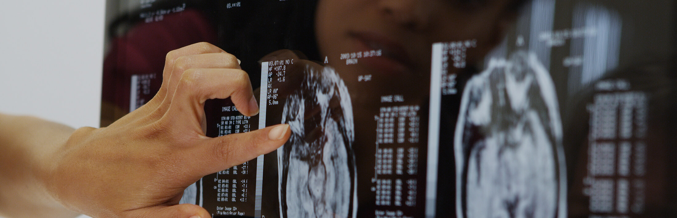 Hand zeigt auf Hirnscan